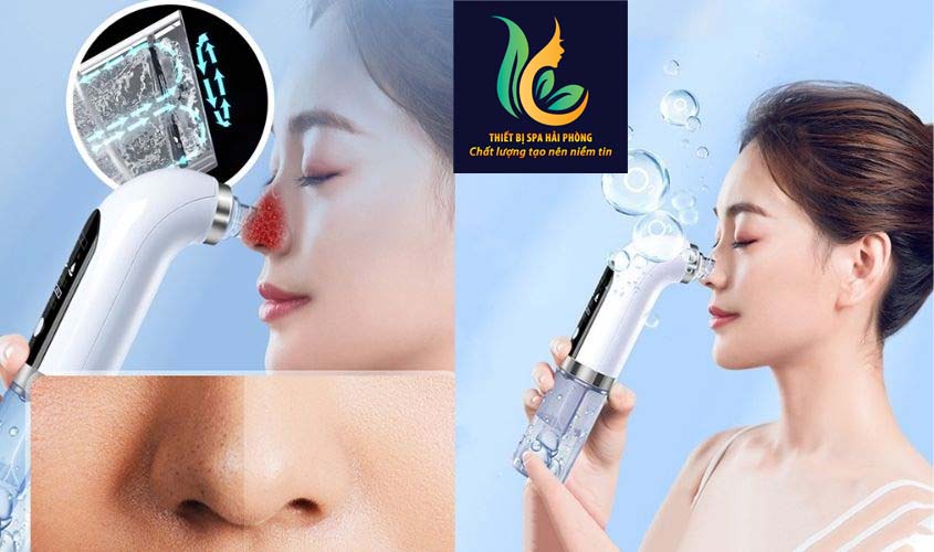 Máy hút mụn các loại tại Hải Phòng. Phân loại, Bảng giá chi tiết may hut mun tai hai phong 13 - Máy hút mụn các loại tại Hải Phòng. Phân loại, Bảng giá chi tiết