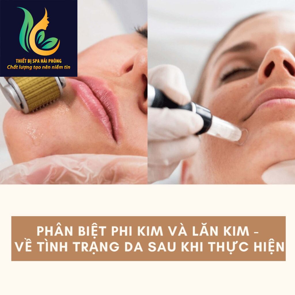 may lan phi kim hai phong 10 1024x1024 - Máy lăn kim phi kim Hải Phòng - Nơi mua uy tín và cách sử dụng