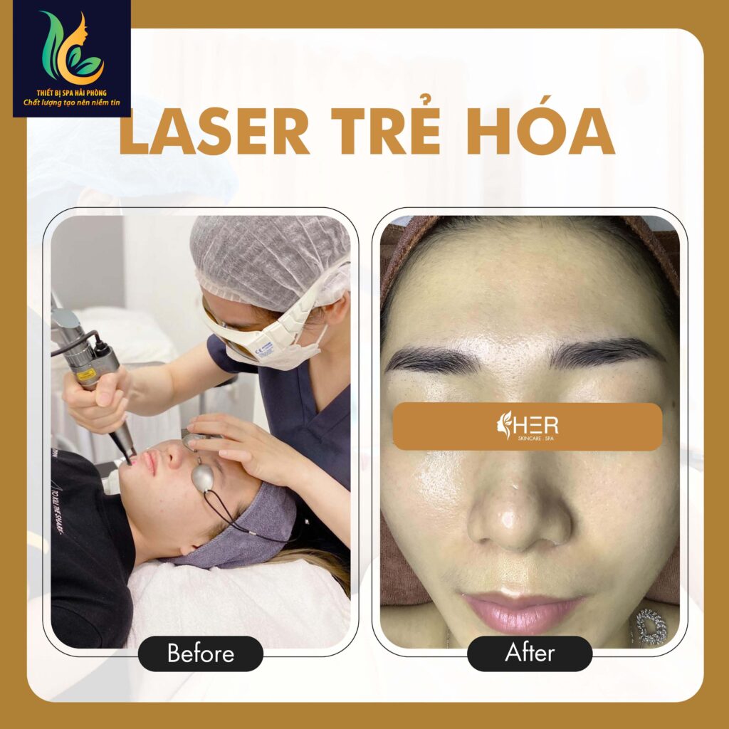chuyen giao cong nghe dieu tri nam chuyen sau hai phong 5 1024x1024 - Chuyển giao công nghệ laser trị nám chân sâu tại Hải Phòng